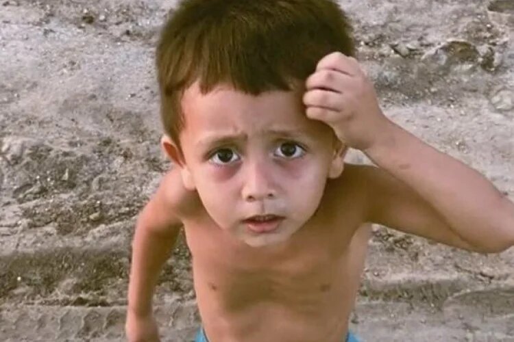 Menino cearense consegue cirurgia com ajuda de vaquinha online