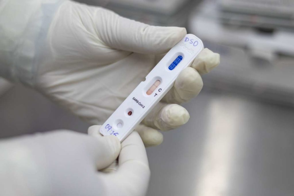 Nova variante da Covid-19 é identificada em três estados brasileiros