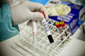 Ceará entra em alerta por aumento de casos graves de gripe