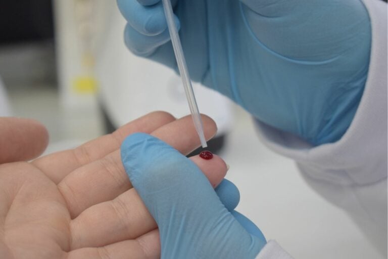 Brasil registra redução de 50% na mortalidade por hepatite B em 10 anos