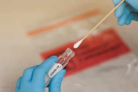 Ceará identifica circulação inédita da variante XFG da Covid