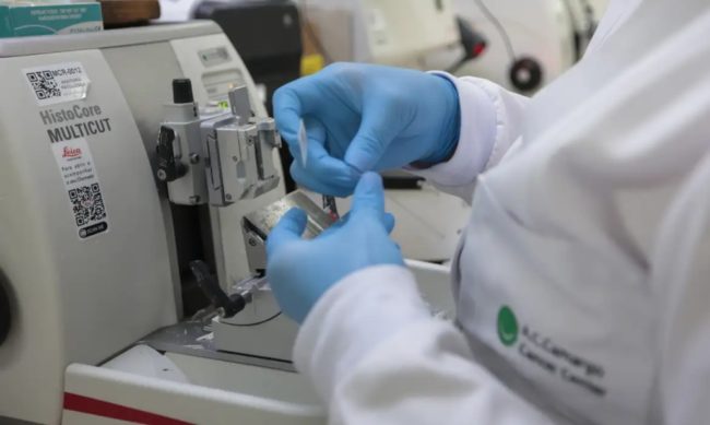 Diagnóstico precoce eleva taxa de cura do câncer de próstata para até 98%