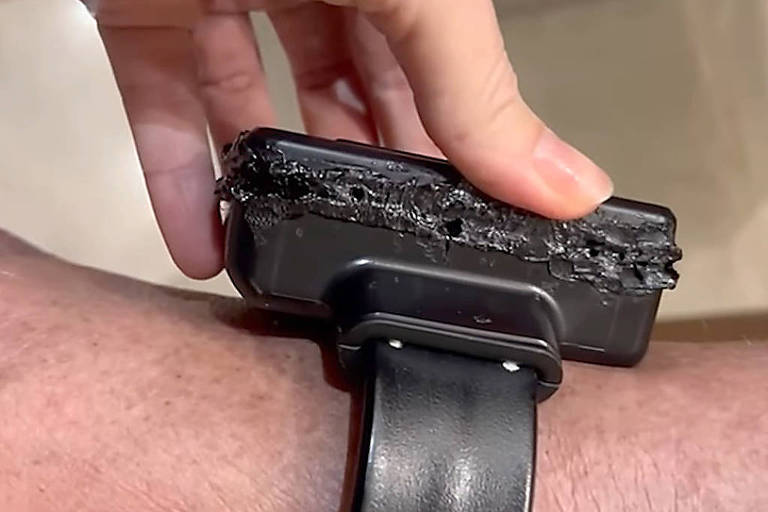 Pesquisa revela que hipótese de fuga supera versão de surto em caso de Bolsonaro