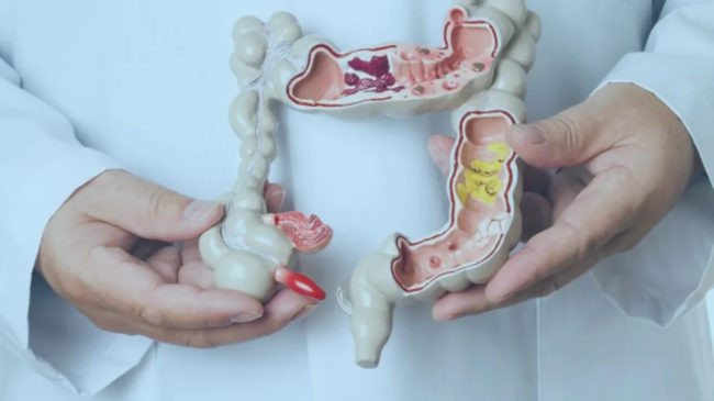 Março Azul reforça importância da prevenção contra o câncer colorretal