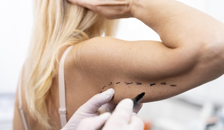 Projeto propõe incluir cirurgias reparadoras pós-bariátrica no SUS