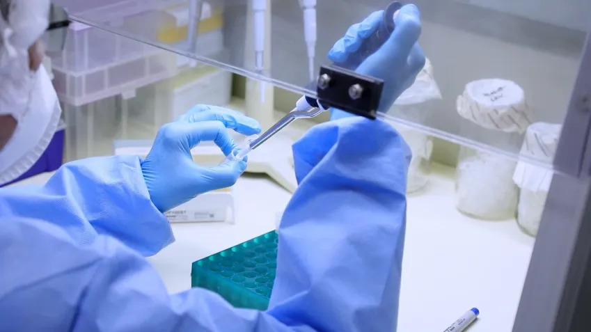 Primeiro caso de Mpox em 2026 é confirmado no Ceará