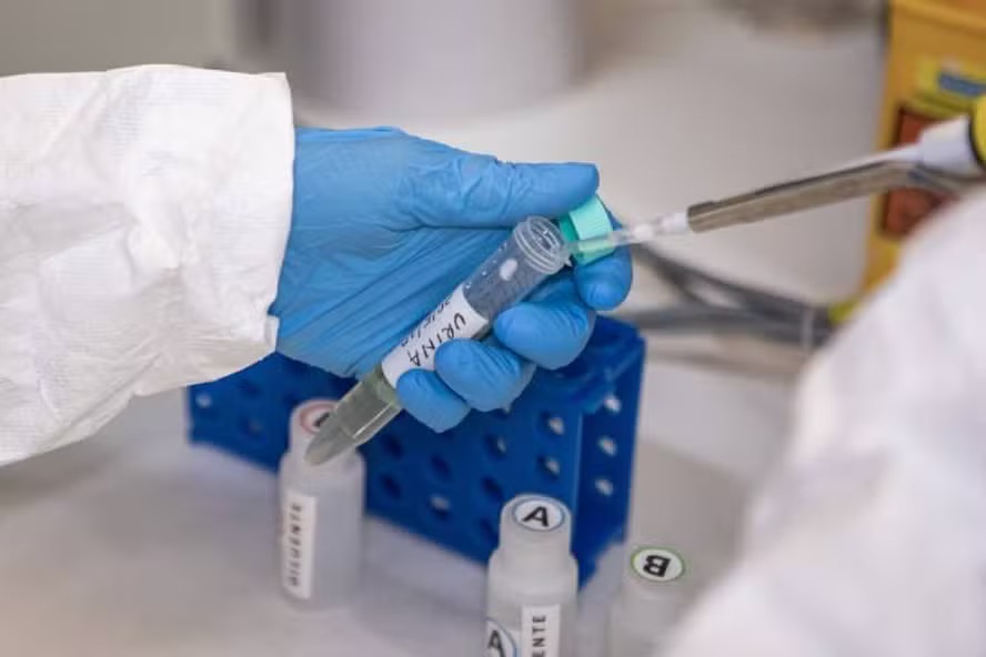 Fortaleza registra 11 casos de leptospirose em 2026