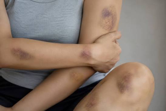 IJF: 76% das mulheres internadas foram agredidas por parceiros ou ex-companheiros