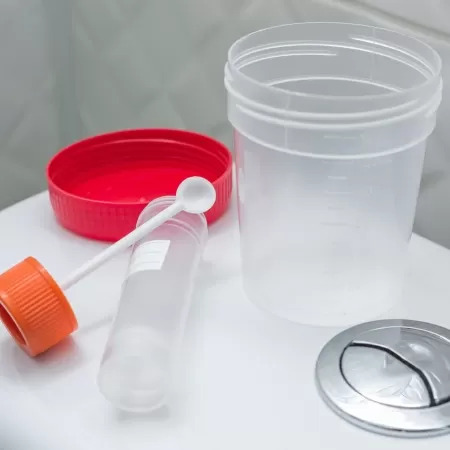 SUS inclui novo teste para rastreamento de câncer colorretal