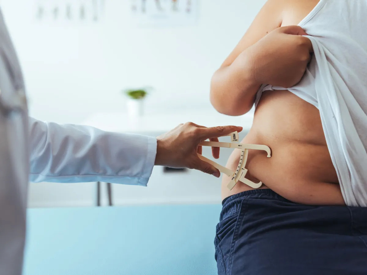 Obesidade mais que triplica entre adultos no Brasil em 33 anos, aponta estudo